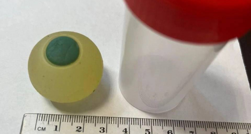 В Челябинске из кишечника ребенка извлекли силиконовый глаз